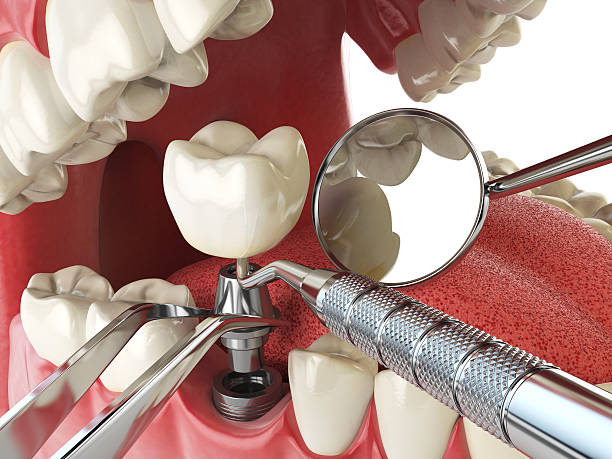 Best Emergency Wisdom Teeth Removal in Aberdeen Proving Ground, MD